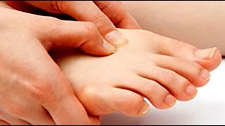 My Personal MD: Do You Have An Arthritic Big Toe Joint? | Podiatry