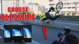 MON ACCIDENT ET FAIL EN VÉLO - LUXATION CLAVICULE