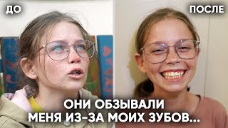 ПРЕОБРАЖЕНИЕ ПРОСТОЙ ДЕВОЧКИ ИЗ ДЕРЕВНИ. ОНА БОЛЬШЕ НЕ СТЕСНЯЕТСЯ СВОЕЙ УЛЫБКИ.