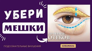 СРОЧНО УБЕРИ МЕШКИ И КРУГИ ПОД ГЛАЗАМИ (ПОДСОЗНАТЕЛЬНЫЕ ВНУШЕНИЯ) SUBLIMINAL