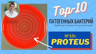 Патогенные бактерии рода Proteus (протеи). Подробный лабораторный обзор (2020)