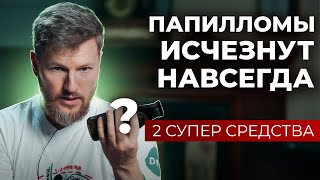 Как избавиться от папиллом и бородавок навсегда? 2 средства для идеальной кожи