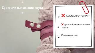 Остановка кровотечения с помощью кровоостанавливающего жгута