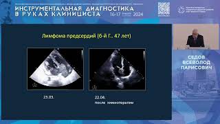 Ультразвуковая диагностика патологических эхопозитивных образований сердца