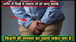 किडनी खराब होने के शुरुआती लक्षण | Early Warning Signs of Kidney Problems | kidney failure signs |