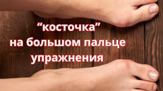 Если закрутило Вас полностью, то и раскручиваться нужно полностью#плоскостопие #большойпалец