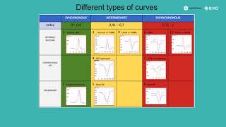 Non invasive cardiac electrical synchrony assessment by EXO-Synchromax method.