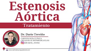 Tratamiento de estenosis aórtica | 🩺 Dr. Treviño