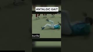 ANTALGIC gait disor #medicosstudypoint #neetpreparation #funny #usmle #medicalstudent #mbbsstudents