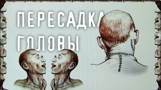 ПЕРЕСАДКА ГОЛОВЫ