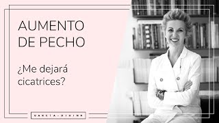 Aumento de pecho - ¿Me dejará cicatrices? | Dra. Garcia-Dihinx