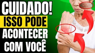 10 MELHORES ALIMENTOS RICOS EM COLÁGENO: Benefícios anti-idade surpreendentes l Depois dos 50