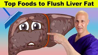 Top Foods to Flush Liver Fat | Dr. Mandell