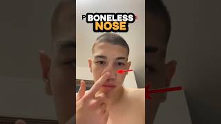 He Has Boneless Nose