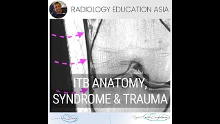 ILIOTIBIAL BAND MRI ANATOMY, SYNDROME & TRAUMA