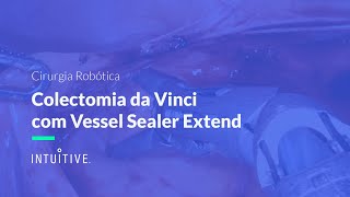 Cirurgia Robótica | Vessel Sealer Extend na Colectomia