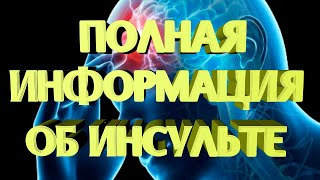 СТРИМ - Полная информация об инсульте