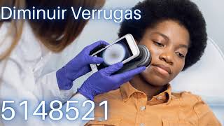 Diminuir Verrugas com Números Grabovoi - 5148521