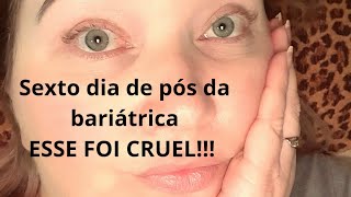 SEXTO DIA... Foi cruel! Muita dor e enjoo!(pós bariátrica)