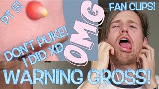 ROUND 5 - DISTURBING TRY NOT TO VOMIT CHALLENGE - PIMPLE EDITION | WORST EVER!