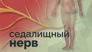 Самые простые и безболезненные упражнения  от боли в седалищниом нерве