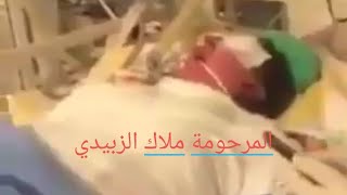 فيديو | اللحظات الأخيرة لـ ملاك الزبيدي قبيل وفاتها بتسمم في الدم، بسبب الحروق التي تعرضت لها