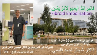 For Fibroid Find the best doctor- Fibroid best treatment is UFE that is embolization Dr Shahbaz Qazi