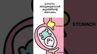 പ്രസവം അടുക്കുമ്പോൾ കുഞ്ഞിന്റെ അനക്കം 💯 #shorts #trending #pregnancy #malayalam