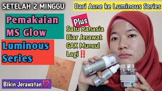 REVIEW MS GLOW LUMINOUS SERIES DARI ACNE SERIES | Skincare Untuk Menghilangkan Bekas Jerawat