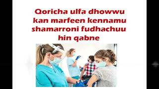 🔴Qoricha ulfa dhowwu isa kam fuhattu kiniini yookis marfee