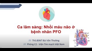 Nhồi máu não ở bệnh nhân còn lổ thông bầu dục