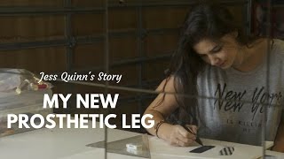 My New Prosthetic Leg: Jess Quinn