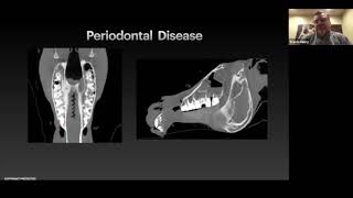 Prosthetic Tooth Case Study