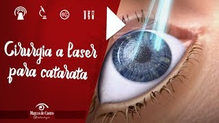 Cirurgia Laser para Catarata - Dr. Marcos de Castro Oftalmologia