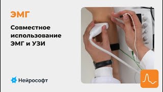 ЭМГ: совместное использование ЭМГ и УЗИ в клинической практике