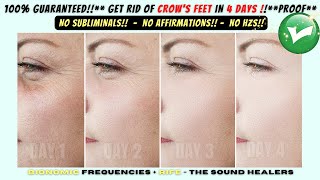 Get Rid Of Crow's Feet!!100%GUARANTEED!!Bionomic Frequency!!No Affirmations or Subliminals **PROOF**