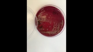 Кишечная палочка — Escherichia coli (E. coli). Методы лабораторной диагностики (посев, определение)