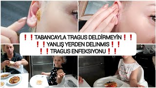 VLOG / TRAGUS DELDİRMEDEN ÖNCE İZLEYİN / YANLIŞ DELİM / TRAGUS ENFEKSIYONU / MORALİM COK BOZUK