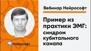 Пример из практики ЭМГ: синдром кубитального канала | Вебинар Нейрософт