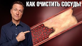 Кальцификация сосудов? Проблемы с сердцем? Причина в этом. 🙌