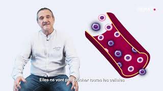 La Minute Hémato : Traitements de la Leucémie Lymphoïde Chronique