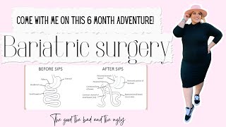 6 MONTH VLOG! PREPARING FOR ￼BARIATRIC SURGERY WEIGHT LOSS SURGERY| GASTRIC BYPASS | SLEEVE SURGERY