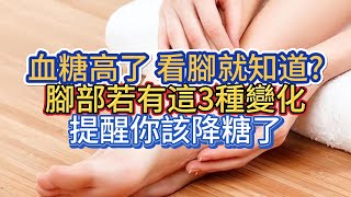 血糖高了，看腳就知道?腳部若有這3種變化，提醒你該降糖了