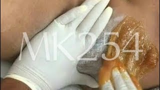 BRAZILIAN BIKINI LINE HARD WAXING FOR BEGINNERS #viral #waxing #sugaring #brazilian