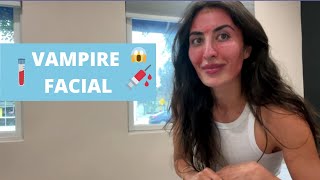 EXPERIENCE THE PRP VAMPIRE FACIAL WITH ME | SaharBabs