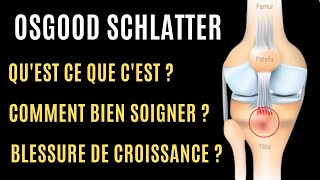 Osgood Schlatter : qu’est ce que c’est ? Blessure de croissance ?