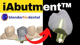 👉 iAbutment - Pilares PERSONALIZADOS con Blender for Dental.!