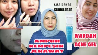 WARDAH ACNEDERM ACNE SPOT TREATMENT GEL