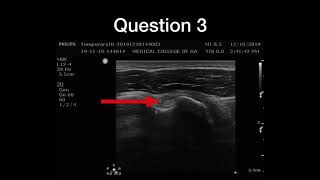 answers for the M2 shoulder lab 2019