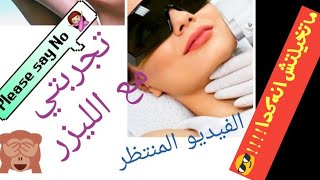 Laser Hair Removal! My Experience/ للبنات فقط /قبل ما تعملي ليزر إزالة الشعر لازم تشوفي هذا الفيديو